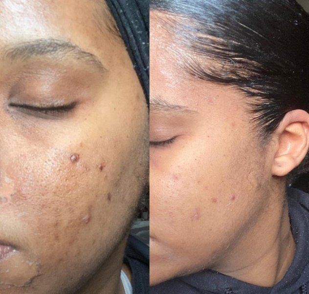 Diagnostic skincare